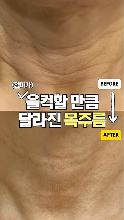 유튜브 쇼츠 썸네일