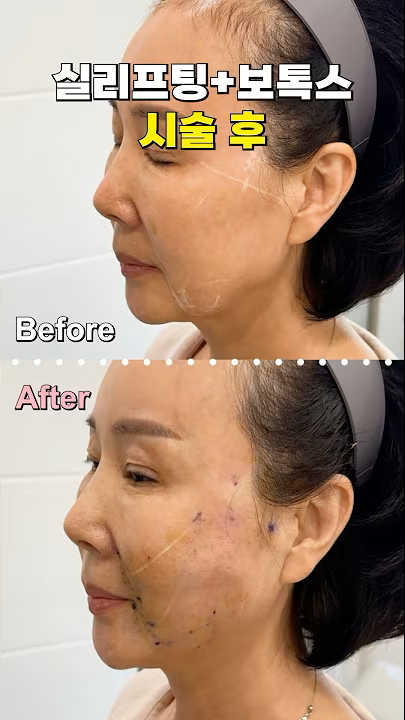 이미지가 없습니다.